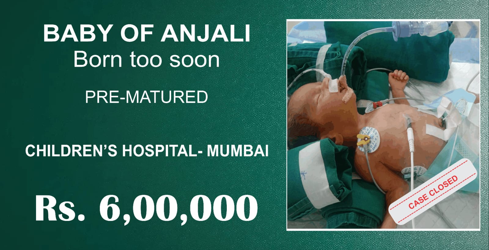 Urgent Help Needed to Save a Premature Baby Boy (CASE CLOSED)